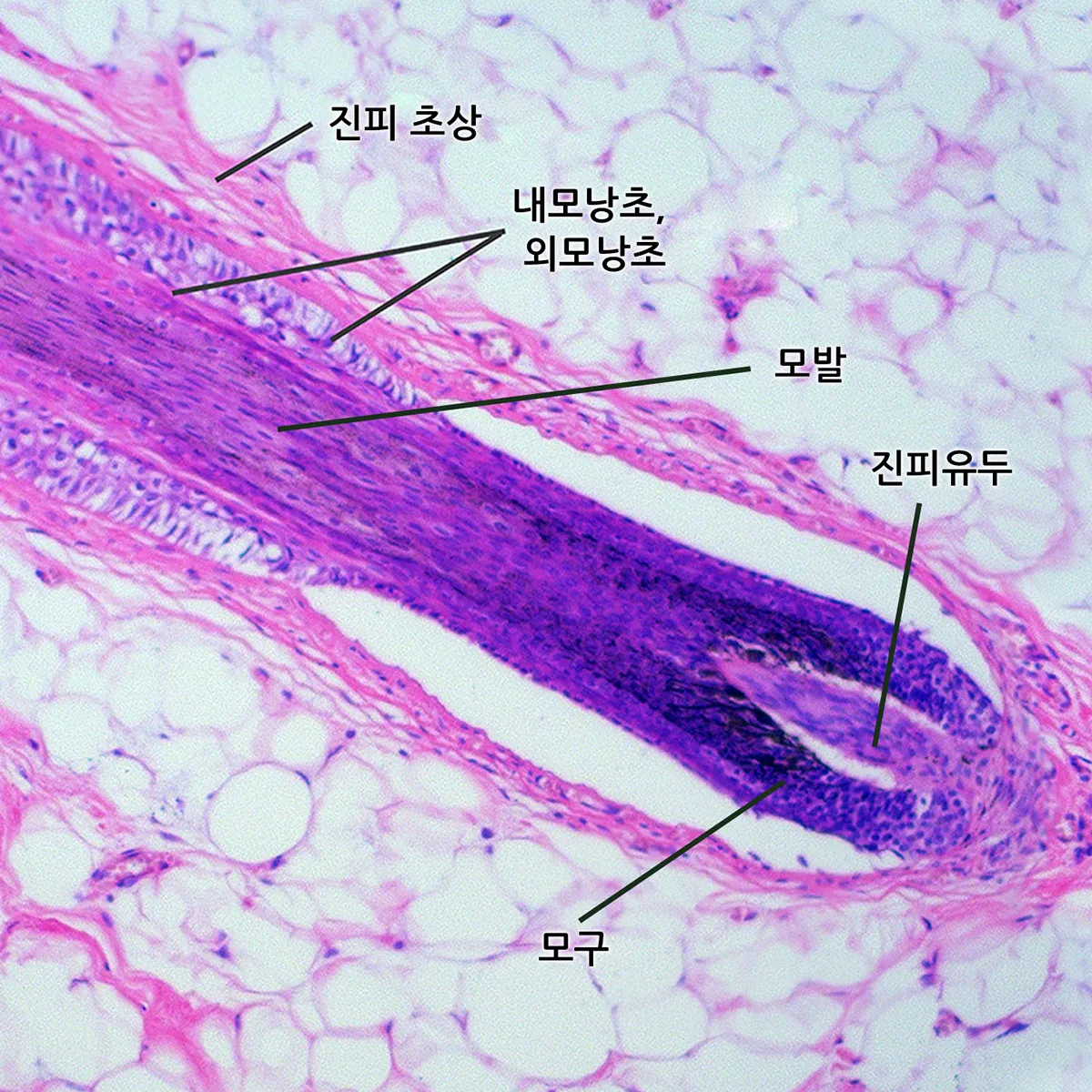 모발 단면 현미경 확대 이미지, 케라틴 단백질로 이루어진 모발의 실제 구조와 탈모 영양제 성분의 작용 부위